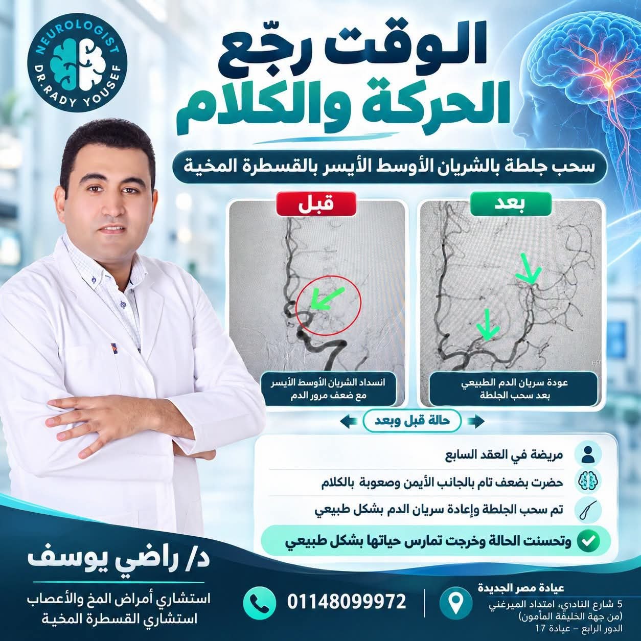 د/ راضي يوسف - علاج الجلطات المخية | جريدة تحت الضوء