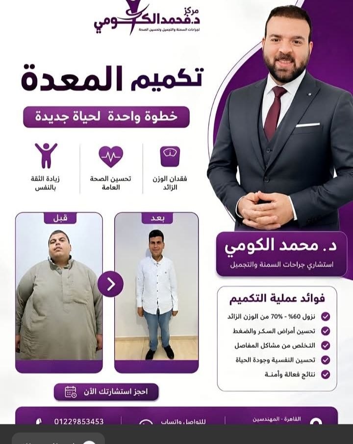 د. محمد الكومي - جراحات السمنة | جريدة تحت الضوء