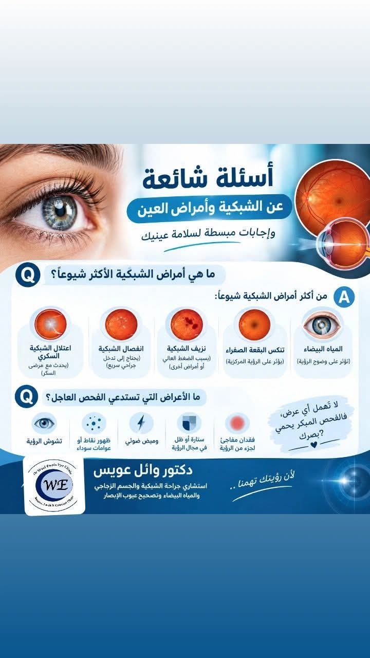 دكتور / وائل عويس - عيادة دكتور وائل عويس للشبكية | جريدة تحت الضوء
